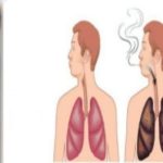 أضرار التدخين على الجسم بالتفصيل 5 أبرزها العقم عند الرجال