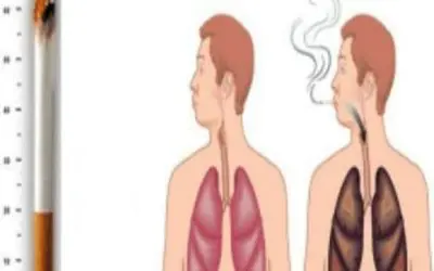 أضرار التدخين على الجسم بالتفصيل 5 أبرزها العقم عند الرجال